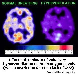 Brain oxygenation for normal breathing and after hyperventilation